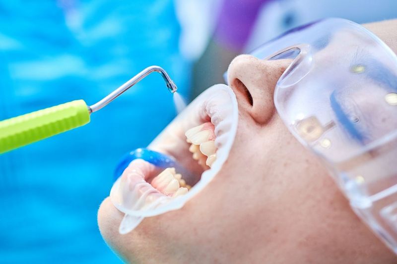 Профессиональная чистка зубов Air-Flow в Щёкино